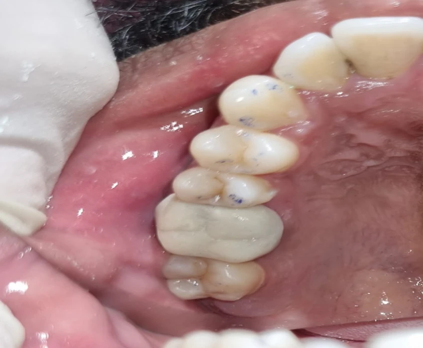 saraswati dental college