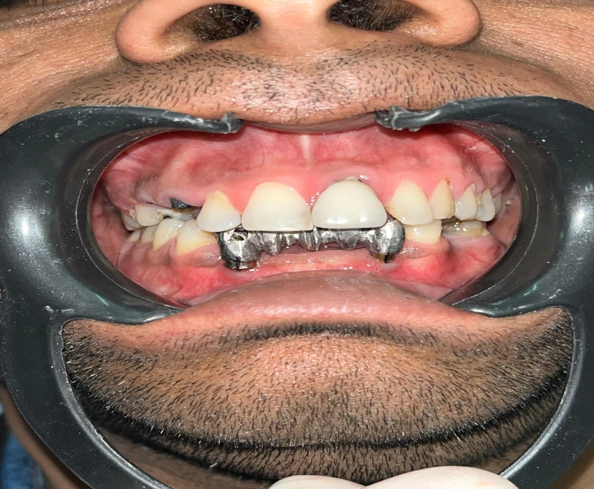 saraswati dental college