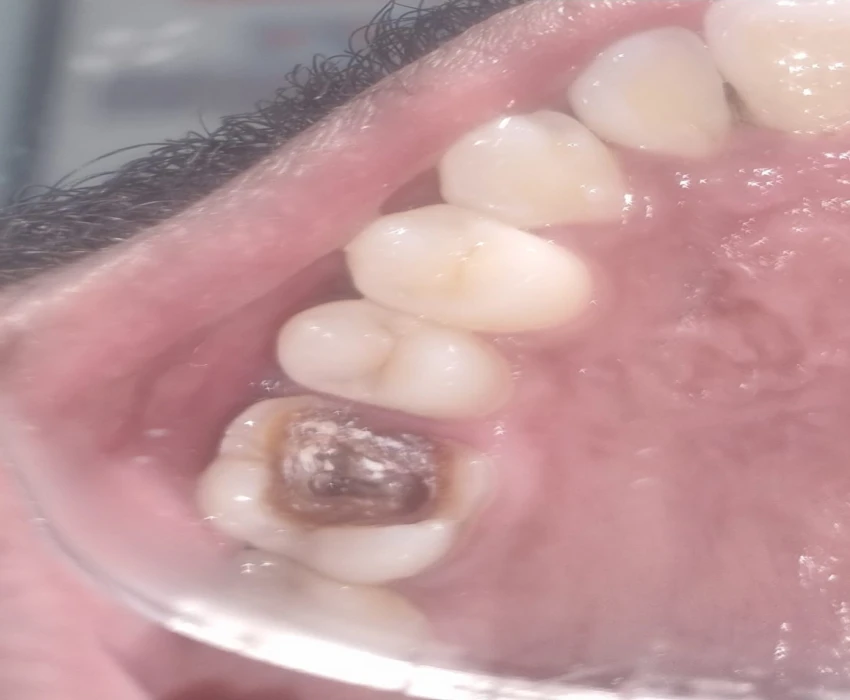 saraswati dental college