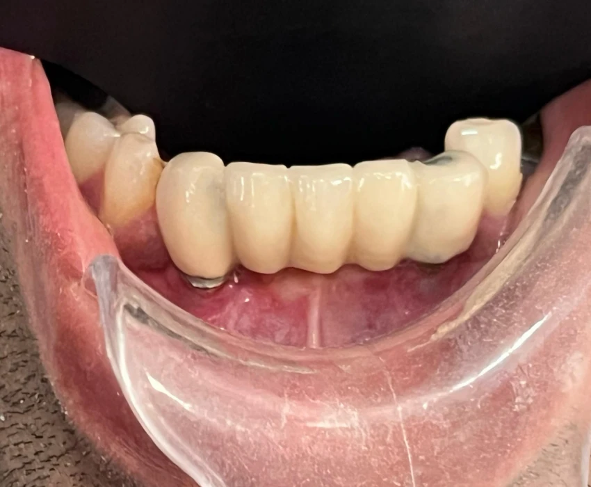 saraswati dental college