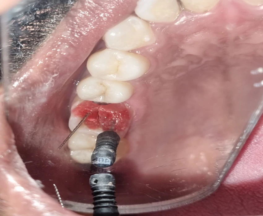 saraswati dental college