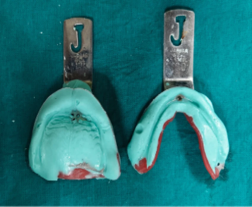 saraswati dental college