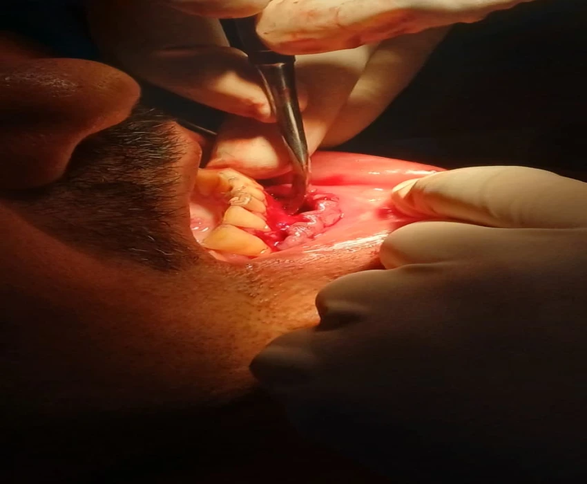 saraswati dental college