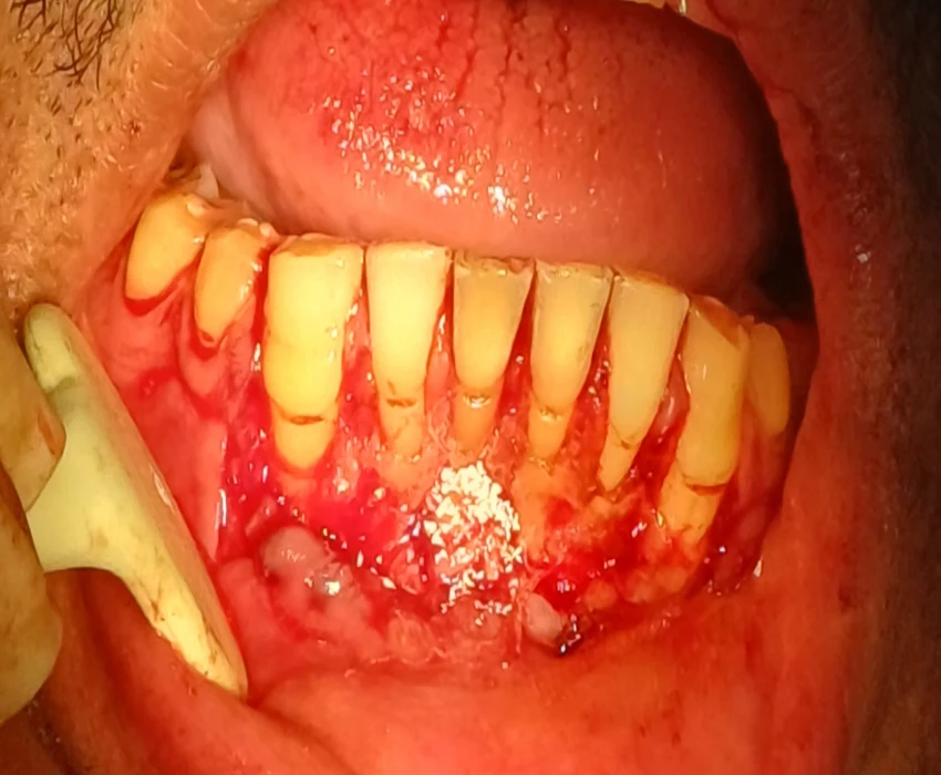 saraswati dental college