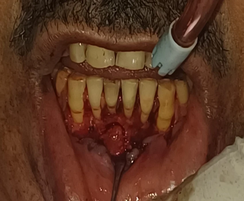 saraswati dental college