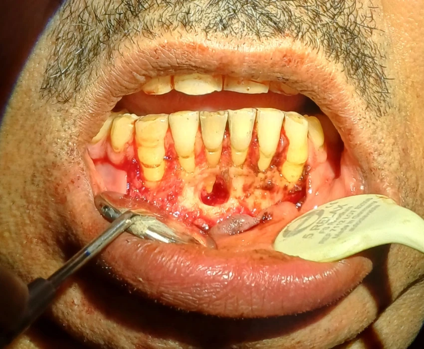 saraswati dental college