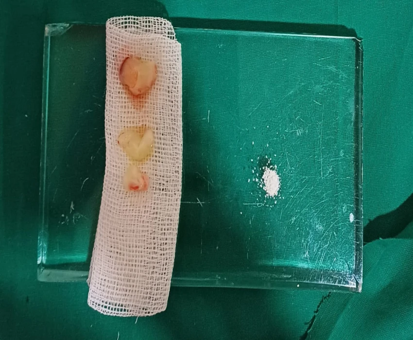 saraswati dental college