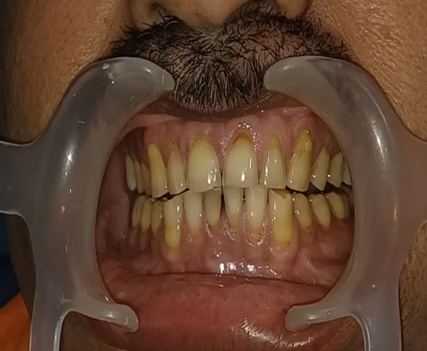 saraswati dental college