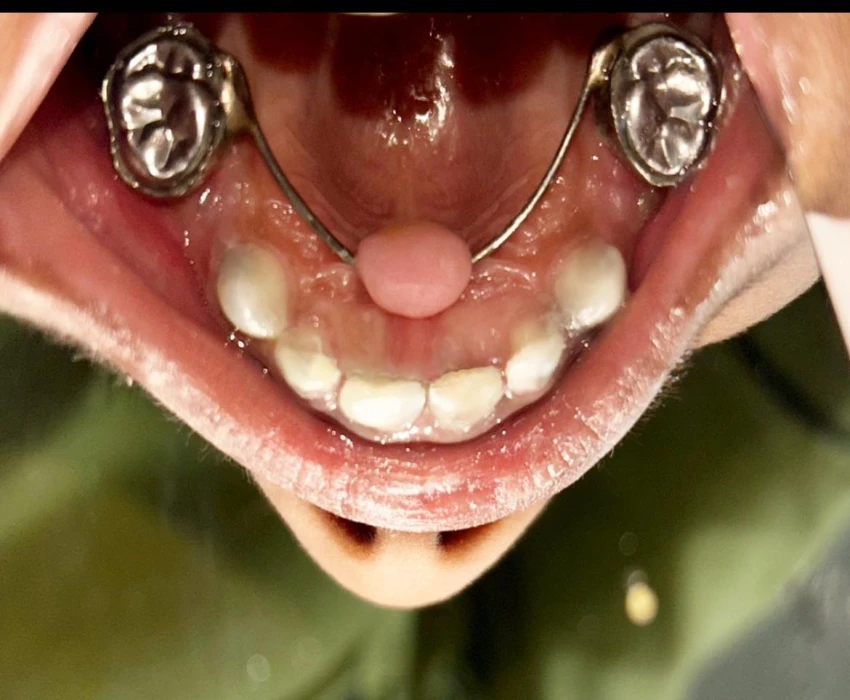 saraswati dental college