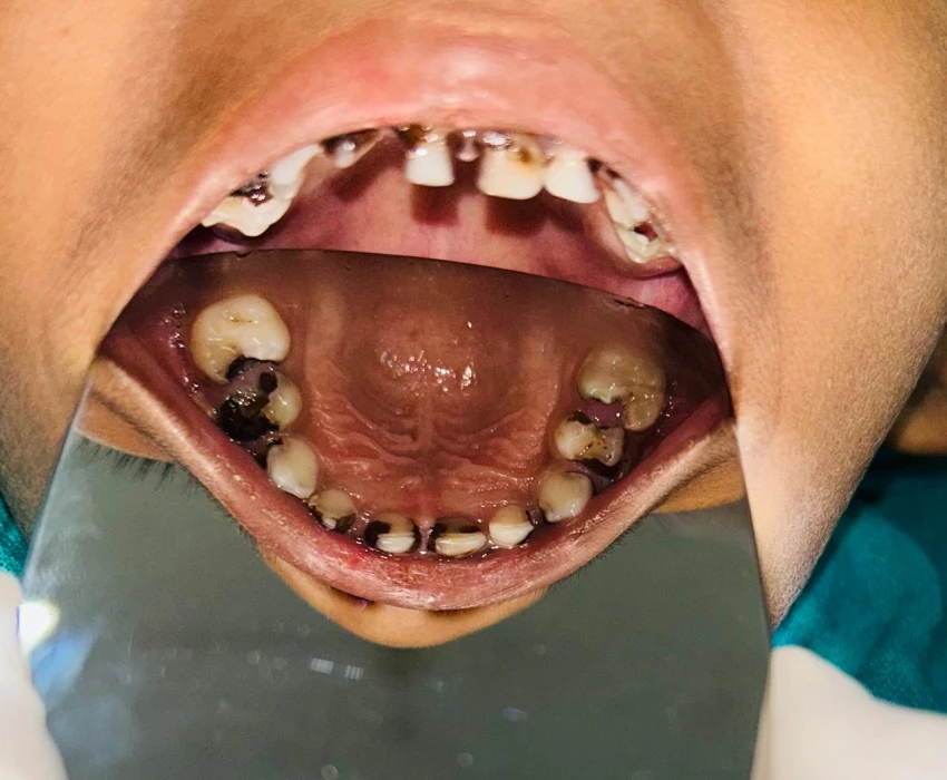 saraswati dental college