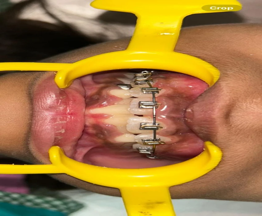 saraswati dental college