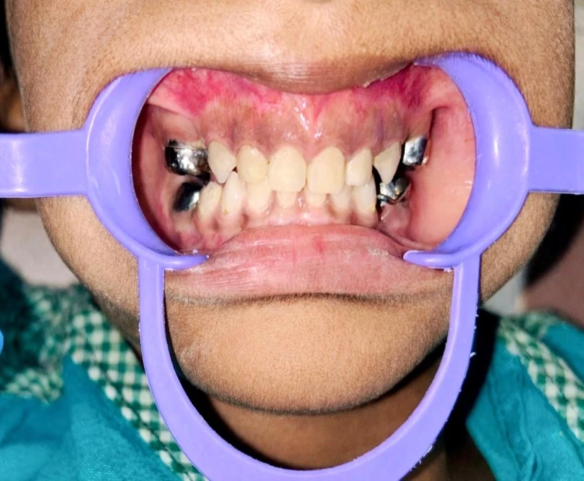 saraswati dental college