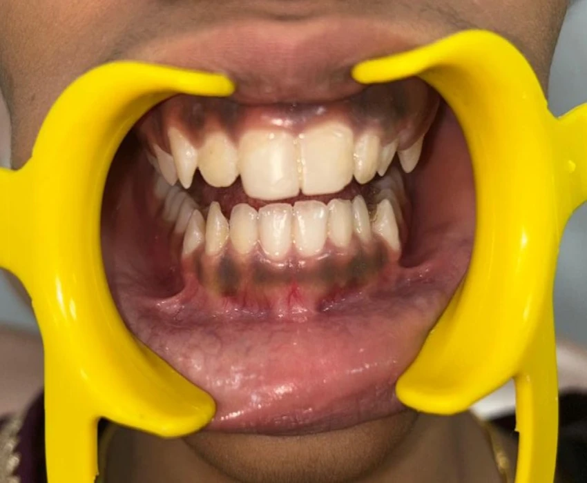 saraswati dental college