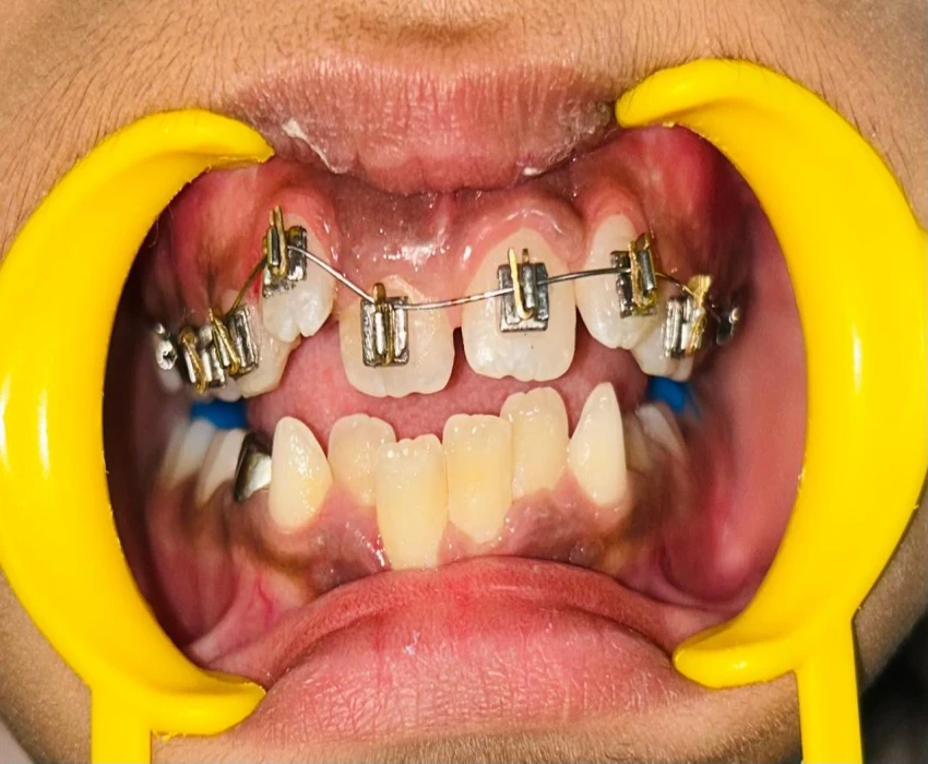 saraswati dental college