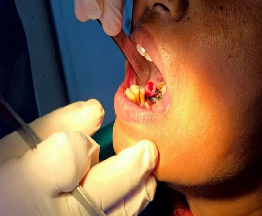 saraswati dental college