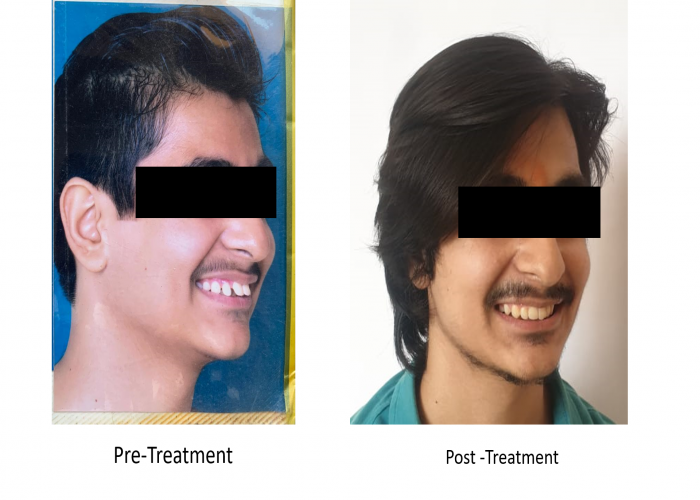 saraswati dental college