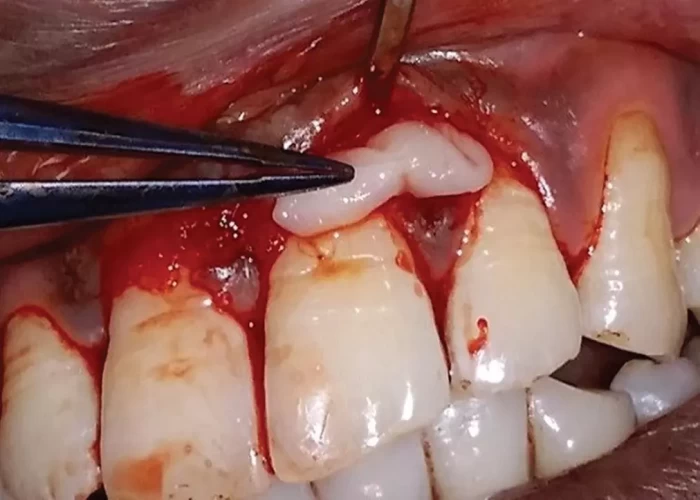 saraswati dental college