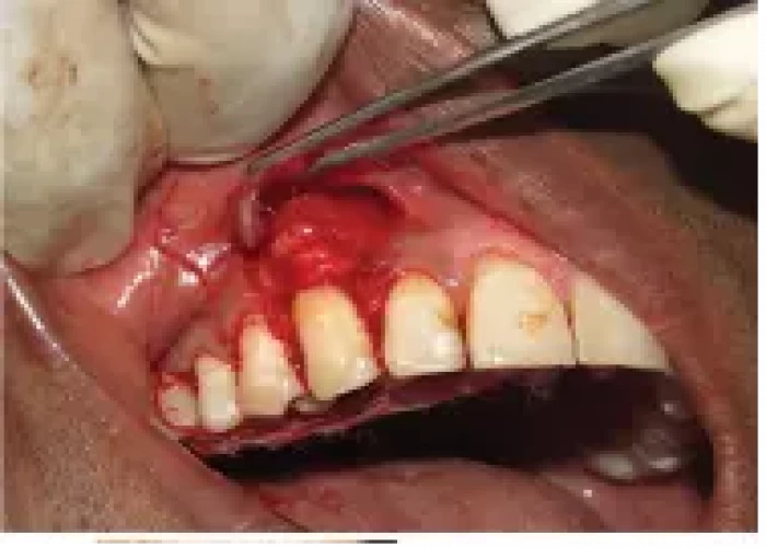 saraswati dental college