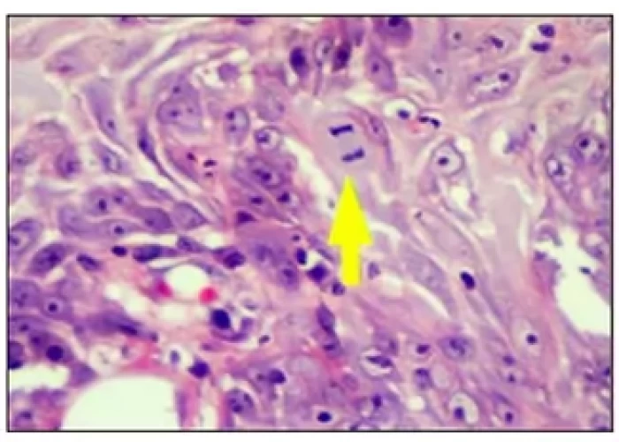 saraswati dental college