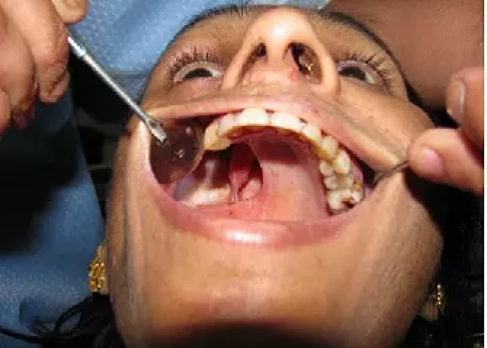 saraswati dental college