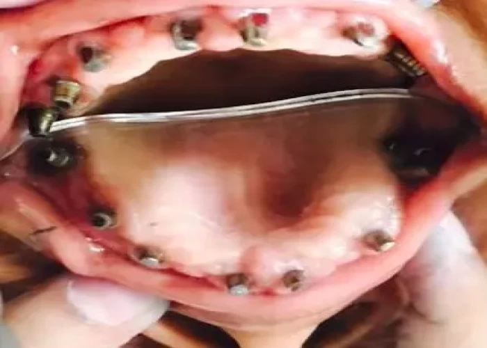 saraswati dental college