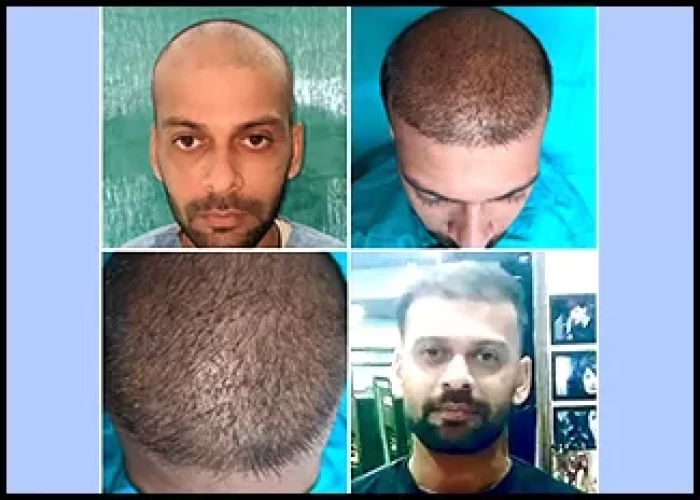 saraswati dental college