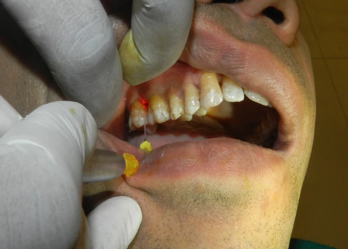 saraswati dental college