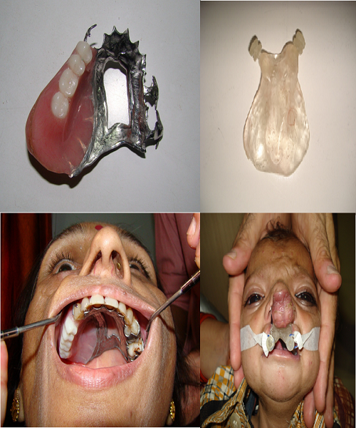 saraswati dental college