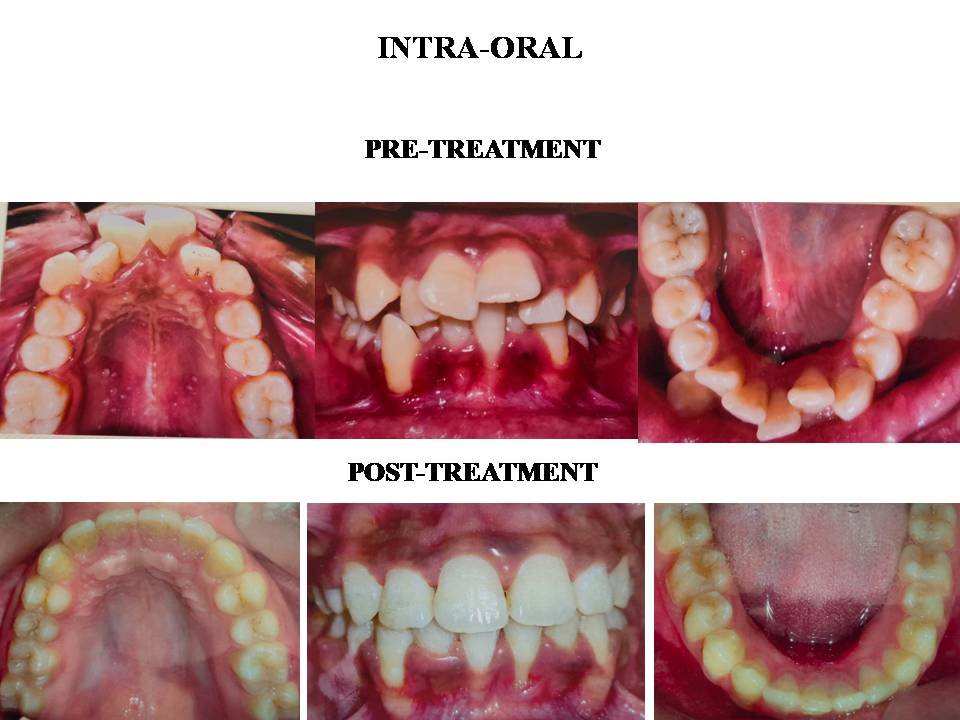saraswati dental college