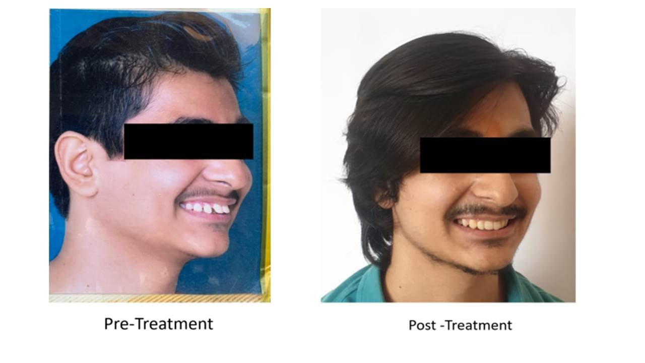 saraswati dental college