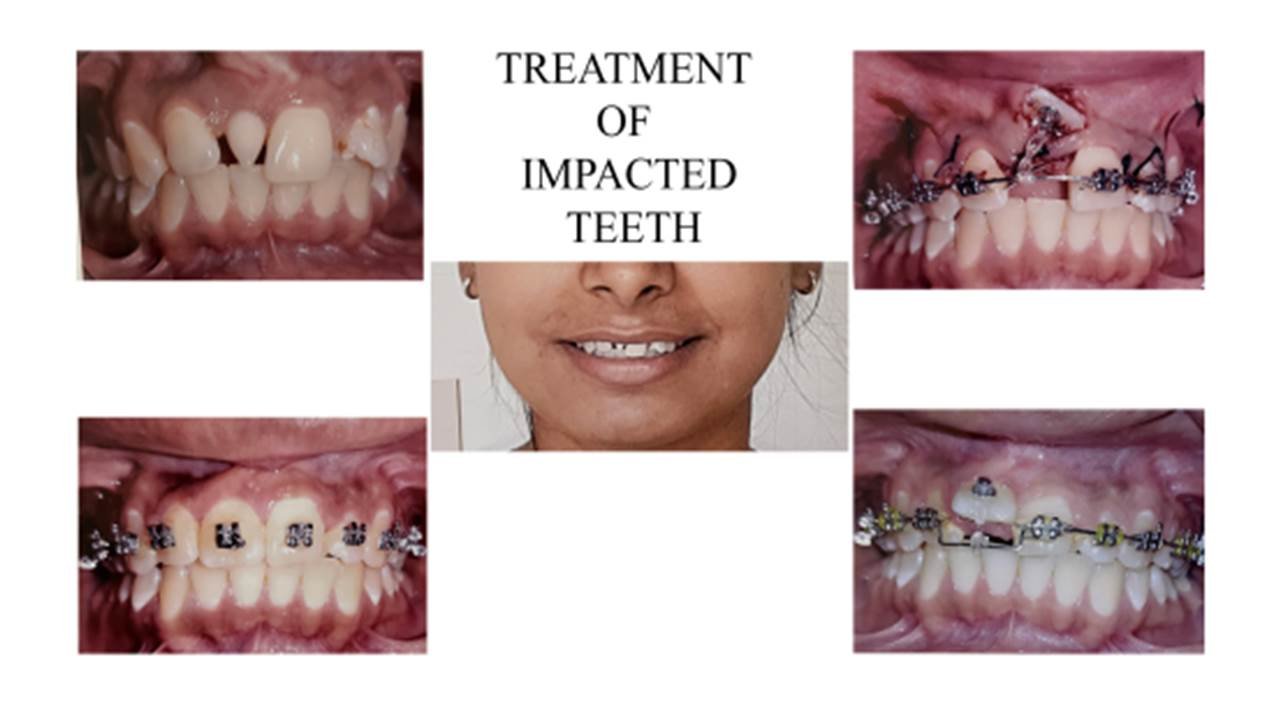 saraswati dental college