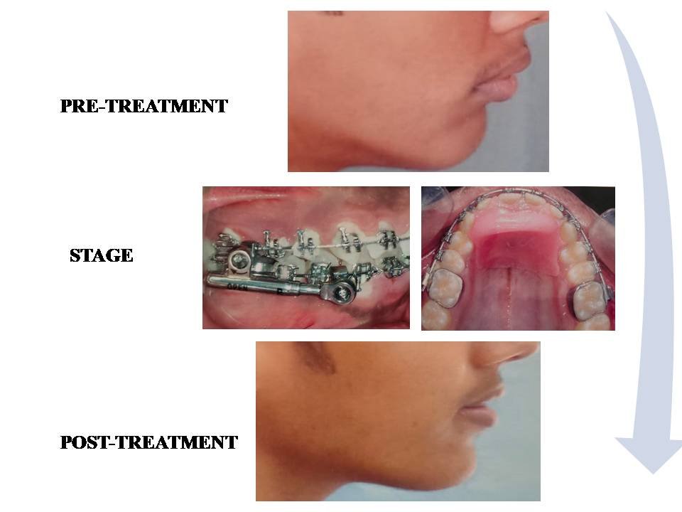 saraswati dental college